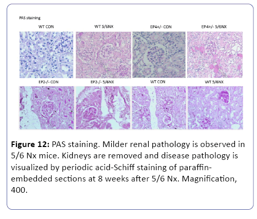clinical-experimental-nephrology-PAS-staining