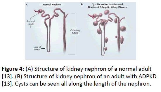 clinical-experimental-nephrology-kidney-nephron